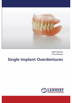 Single Implant Overdentures