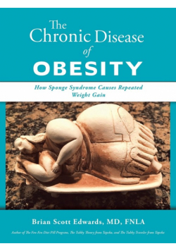The Chronic Disease of Obesity