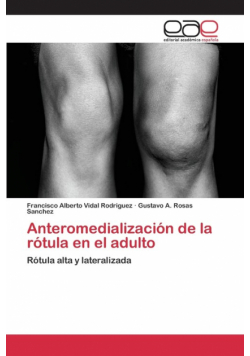 Anteromedialización de la rótula en el adulto