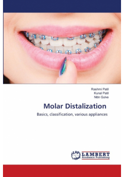 Molar Distalization