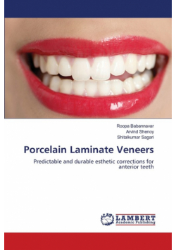 Porcelain Laminate Veneers
