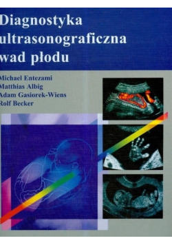 Diagnostyka ultrasonograficzna wad płodu