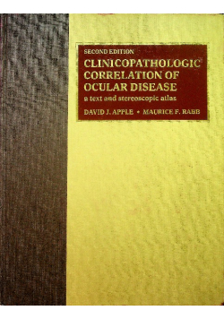 Clinicopathologic correlation of ocular disease