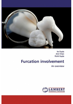 Furcation involvement