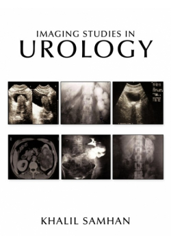 Imaging Studies in Urology