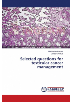 Selected questions for testicular cancer management