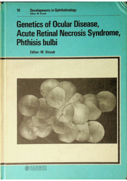 Genetics of ocular disease acute Retinal Necrosis Syndrome Phthisis bulbi