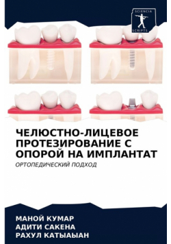 ЧЕЛЮСТНО-ЛИЦЕВОЕ ПРОТЕЗИРОВАНИЕ С ОПОРОЙ НА ИМПЛАНТАТ