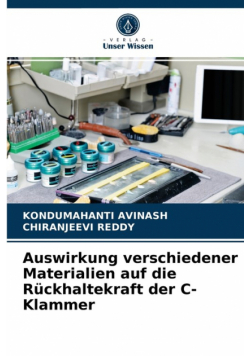 Auswirkung verschiedener Materialien auf die Rückhaltekraft der C-Klammer