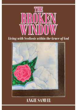 The Broken Window