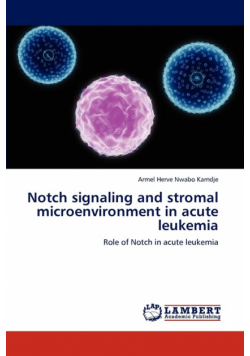 Notch Signaling and Stromal Microenvironment in Acute Leukemia