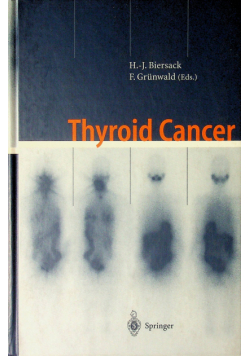 Thyroid Cancer