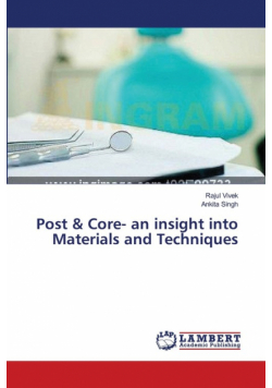 Post & Core- an insight into Materials and Techniques