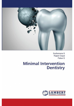 Minimal Intervention Dentistry