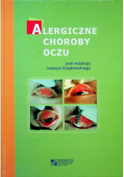 Alergiczne choroby oczu