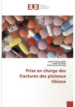 Prise en charge des fractures des plateaux tibiaux