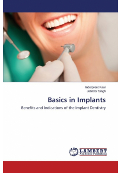 Basics in Implants