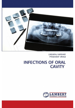 Infections Of Oral Cavity
