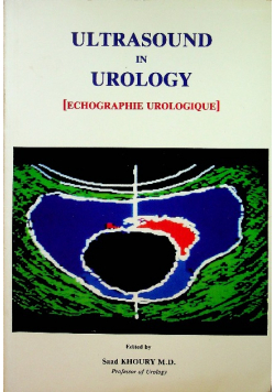 Ultrasound in urology  Echographie urologique