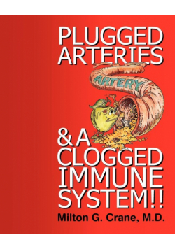 Plugged Arteries & A Clogged Immune System!!