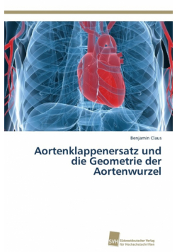 Aortenklappenersatz und die Geometrie der Aortenwurzel