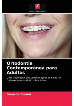 Ortodontia Contemporânea para Adultos