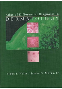 Atlas of Differential Diagnosis in Dermatologyof D