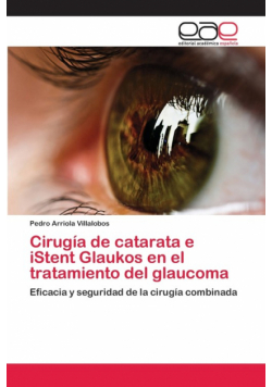 Cirugía de catarata e iStent Glaukos en el tratamiento del glaucoma