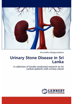 Urinary Stone Disease in Sri Lanka