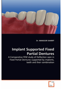 Implant Supported Fixed Partial Dentures