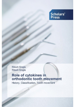 Role of cytokines in orthodontic tooth movement