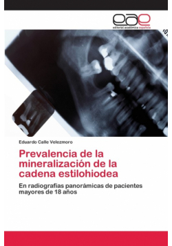 Prevalencia de la mineralización de la cadena estilohiodea