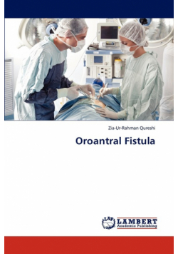 Oroantral Fistula