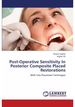 Post-Operative Sensitivity in Posterior Composite Placed Restorations