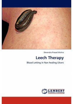 Leech Therapy