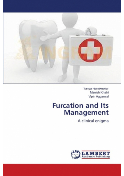 Furcation and Its Management