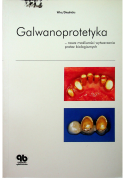 Galwanoprotetyka