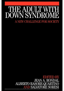 Adult with Down Syndrome