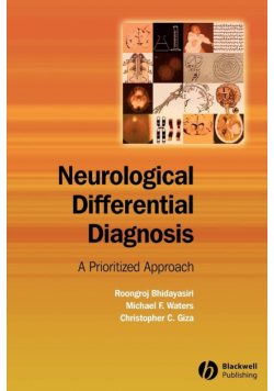 Neurological Differential Diagnosis