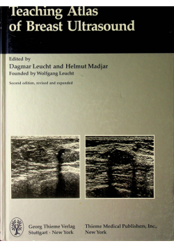 Teaching atlas of breast ultrasound