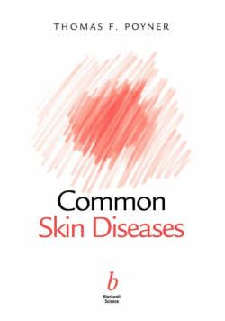 Common Skin Diseases