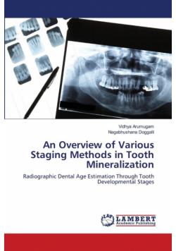 An Overview of Various Staging Methods in Tooth Mineralization