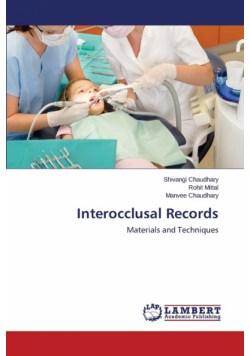 Interocclusal Records