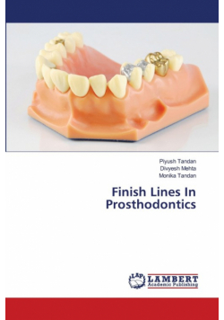 Finish Lines In Prosthodontics