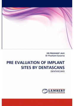 Pre Evaluation of Implant Sites by Dentascans