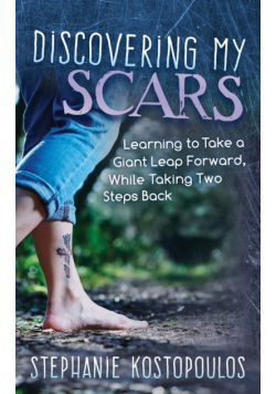 Discovering My Scars