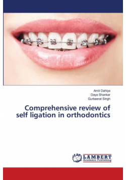Comprehensive review of self ligation in orthodontics