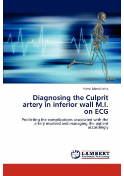 Diagnosing the Culprit artery in inferior wall M.I. on ECG