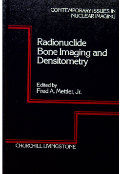 Radionuclide Bone imaging and densitometry