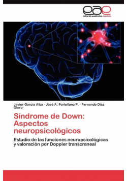 Síndrome de Down